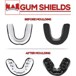 MAR-123B | Purple Gel Mouth Guard/Gum Shield - Small Accessories