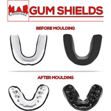 MAR-123B | Purple Gel Mouth Guard/Gum Shield - Small Accessories