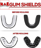 MAR-123C | Black Double Boxing Mouth Guard/Gum Shield